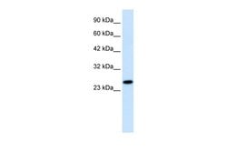 Invitrogen RGS13 Polyclonal Antibody 100 &mu;L; Unconjugated:Antibodies,