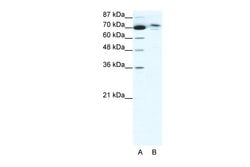 Invitrogen TMEM260 Polyclonal Antibody 100 &mu;L; Unconjugated:Antibodies,