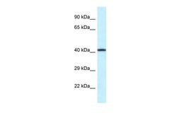 Invitrogen P2X2 Polyclonal Antibody 100 &mu;L | Buy Online | Invitrogen&trade; | Fisher Scientific