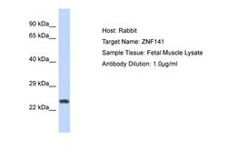Invitrogen ZNF732 Polyclonal Antibody 100 &mu;L; Unconjugated:Antibodies,