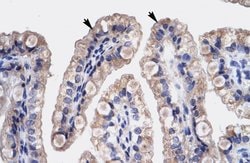 Invitrogen HMGB3 Polyclonal Antibody 100 &mu;L; Unconjugated:Antibodies,