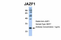 Invitrogen JAZF1 Polyclonal Antibody 100 &mu;L; Unconjugated:Antibodies,