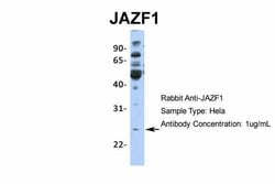 Invitrogen JAZF1 Polyclonal Antibody 100 &mu;L; Unconjugated:Antibodies,