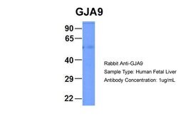 Invitrogen GJA9 Polyclonal Antibody 100 &mu;L; Unconjugated:Antibodies,