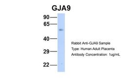 Invitrogen GJA9 Polyclonal Antibody 100 &mu;L; Unconjugated:Antibodies,