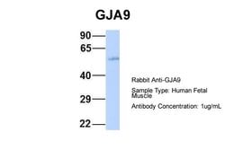 Invitrogen GJA9 Polyclonal Antibody 100 &mu;L; Unconjugated:Antibodies,