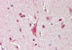 Invitrogen MXI1 Polyclonal Antibody 100 &mu;L; Unconjugated:Antibodies,