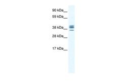 Invitrogen ESX1 Polyclonal Antibody 100 &mu;L; Unconjugated:Antibodies,