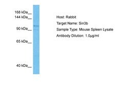 Invitrogen SIN3B Polyclonal Antibody 100 &mu;L; Unconjugated:Antibodies,