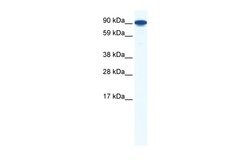 Invitrogen ZFY1 Polyclonal Antibody 100 &mu;L; Unconjugated:Antibodies,