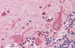 Invitrogen ATF4 Polyclonal Antibody 100 &mu;L; Unconjugated:Antibodies,