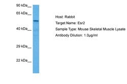 Invitrogen Estrogen Receptor beta Polyclonal Antibody 100 &mu;L; Unconjugated:Antibodies,