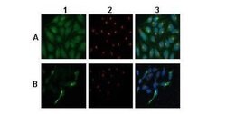 Invitrogen ATP6V0A1 Polyclonal Antibody 100 &mu;L; Unconjugated:Antibodies,
