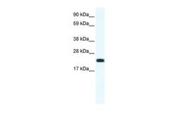 Invitrogen CITED4 Polyclonal Antibody 100 &mu;L; Unconjugated:Antibodies,