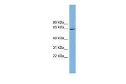 Invitrogen TAF1B Polyclonal Antibody 100 &mu;L | Buy Online | Invitrogen&trade; | Fisher Scientific