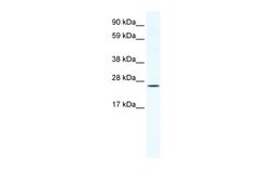 Invitrogen BRF1 Polyclonal Antibody 100 &mu;L; Unconjugated:Antibodies,