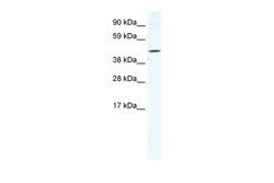 Invitrogen TTC19 Polyclonal Antibody 100 &mu;L; Unconjugated:Antibodies,