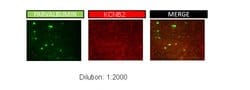 KVbeta2 (KCNAB2) Polyclonal Antibody:Antibodies, Polyclonal
