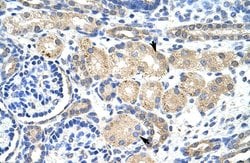 KVbeta2 (KCNAB2) Polyclonal Antibody:Antibodies, Polyclonal