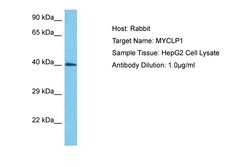 MYCLP1 Polyclonal Antibody:Antibodies, Polyclonal