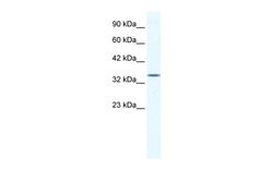 Invitrogen ZNF589 Polyclonal Antibody 100 &mu;L | Buy Online | Invitrogen&trade; | Fisher Scientific
