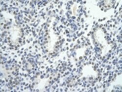 Invitrogen ZNF264 Polyclonal Antibody 100 &mu;L; Unconjugated:Antibodies,