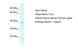 Invitrogen LHX2 Polyclonal Antibody 100 &mu;L; Unconjugated:Antibodies,