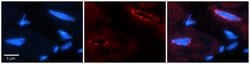 Invitrogen TCF20 Polyclonal Antibody 100 &mu;L; Unconjugated:Antibodies,