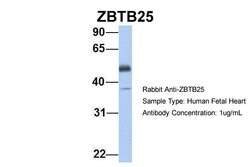 Invitrogen ZBTB25 Polyclonal Antibody 100 &mu;L; Unconjugated:Antibodies,