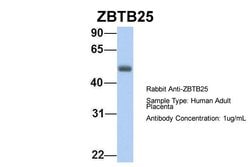 Invitrogen ZBTB25 Polyclonal Antibody 100 &mu;L; Unconjugated:Antibodies,