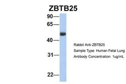 Invitrogen ZBTB25 Polyclonal Antibody 100 &mu;L; Unconjugated:Antibodies,