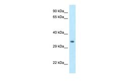 Invitrogen HOXC11 Polyclonal Antibody 100 &mu;L; Unconjugated:Antibodies,