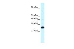 Invitrogen HOXB9 Polyclonal Antibody 100 &mu;L; Unconjugated:Antibodies,