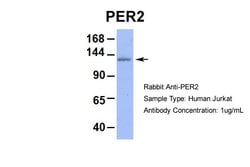 Invitrogen PER2 Polyclonal Antibody 100 &mu;L; Unconjugated:Antibodies,