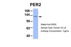 Invitrogen PER2 Polyclonal Antibody 100 &mu;L; Unconjugated:Antibodies,