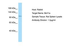 Invitrogen BCL11A Polyclonal Antibody 100 &mu;L; Unconjugated:Antibodies,