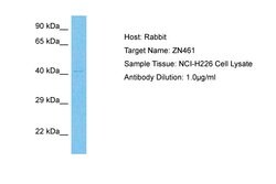 ZNF461 Polyclonal Antibody:Antibodies, Polyclonal