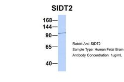 Invitrogen SIDT2 Polyclonal Antibody 100 &mu;L; Unconjugated:Antibodies,