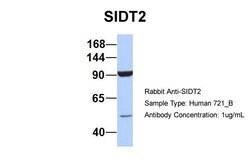 Invitrogen SIDT2 Polyclonal Antibody 100 &mu;L; Unconjugated:Antibodies,