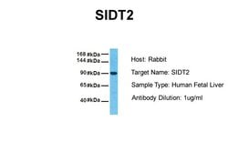 Invitrogen SIDT2 Polyclonal Antibody 100 &mu;L; Unconjugated:Antibodies,