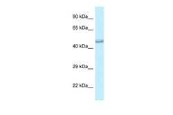Invitrogen PRMT6 Polyclonal Antibody 100 &mu;L; Unconjugated:Antibodies,