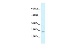 Invitrogen RBM3 Polyclonal Antibody 100 &mu;L | Buy Online | Invitrogen&trade; | Fisher Scientific