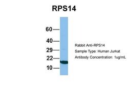 Invitrogen RPS14 Polyclonal Antibody 100 &mu;L; Unconjugated:Antibodies,