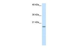 Invitrogen RPS14 Polyclonal Antibody 100 &mu;L; Unconjugated:Antibodies,