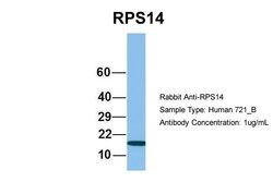 Invitrogen RPS14 Polyclonal Antibody 100 &mu;L; Unconjugated:Antibodies,
