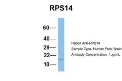 Invitrogen RPS14 Polyclonal Antibody 100 &mu;L; Unconjugated:Antibodies,