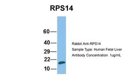 Invitrogen RPS14 Polyclonal Antibody 100 &mu;L; Unconjugated:Antibodies,