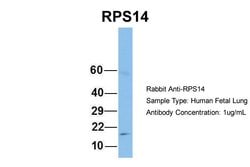Invitrogen RPS14 Polyclonal Antibody 100 &mu;L; Unconjugated:Antibodies,