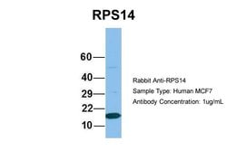 Invitrogen RPS14 Polyclonal Antibody 100 &mu;L; Unconjugated:Antibodies,