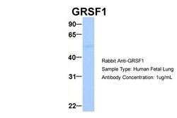 Invitrogen GRSF1 Polyclonal Antibody 100 &mu;L; Unconjugated:Antibodies,